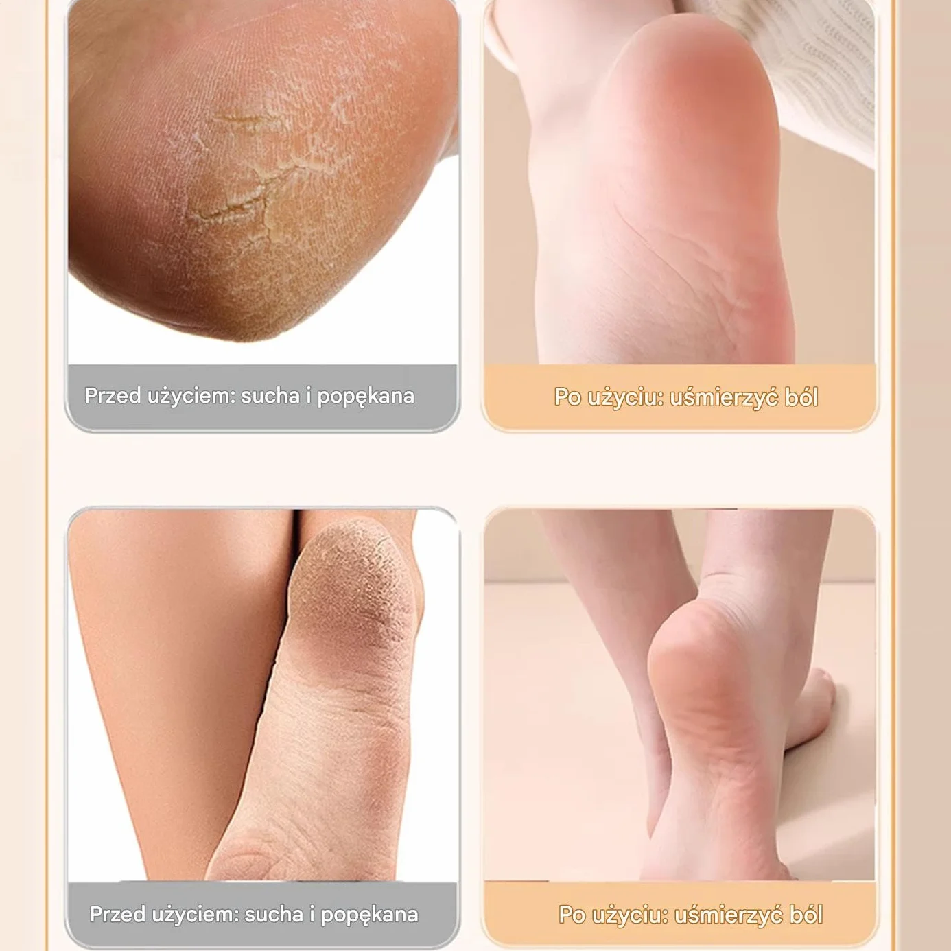 Silicone Socks for Dry Cracked Feet, Breathable Skin-Friendly U-Shape Heel Covers, Soft Spa Foot Care for Cracked Heels, Ideal for Family, Friends, Colleagues