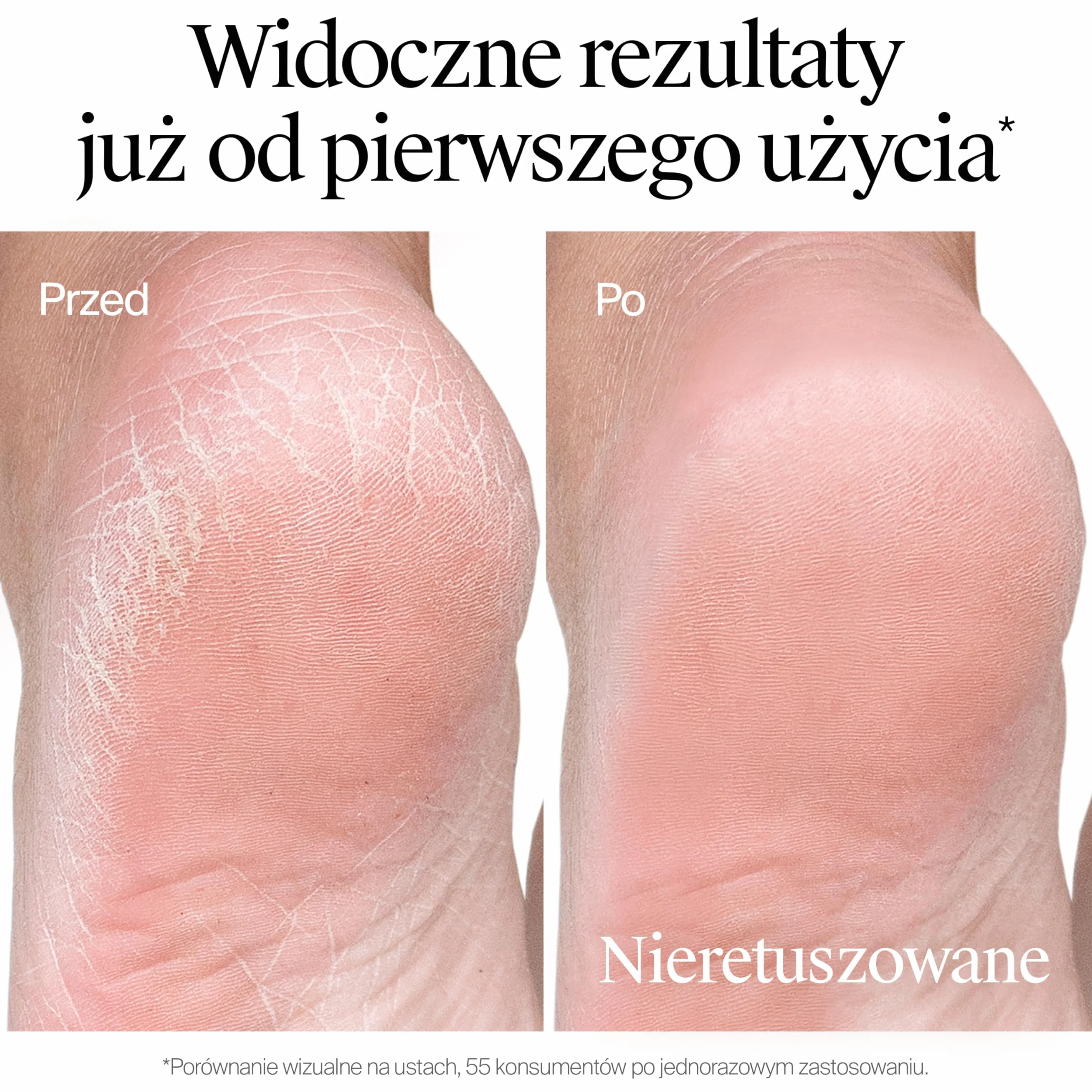 NEUTROGENA® Formuła Norweska® Intensywnie regenerujący krem do stóp 50ml szt, Formuła Norweska, Nawilża i łagodzi suche, zniszczone i popękane pięty.