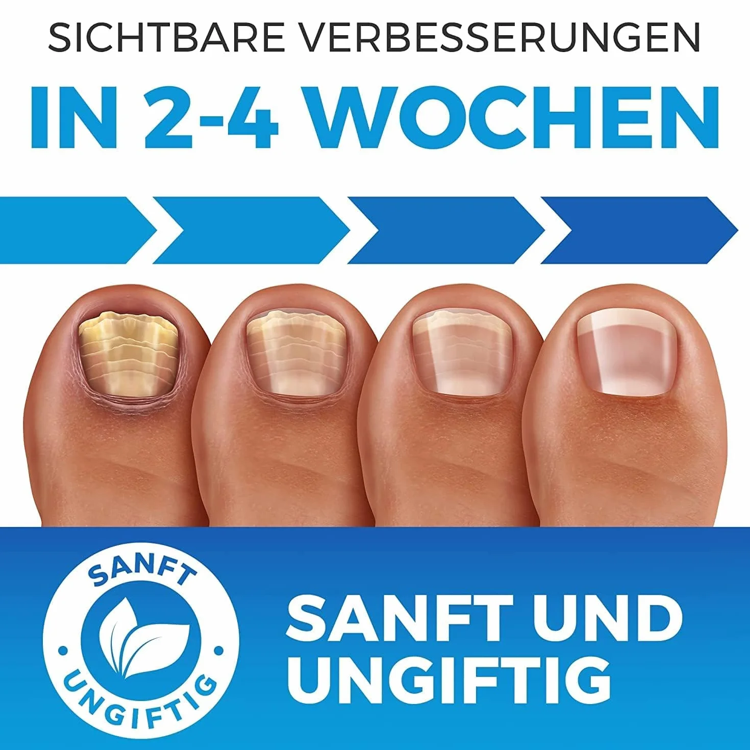 Imperial Feet Środek na Grzybicę Paznokci - Naturalny Preparat na Grzybice i Choroby - Krople z Gliceryną, Olejkiem Jojoba i z Drzewa Herbacianego, Bez Wody - Wyprodukowany w Europie - Butelka 75ml