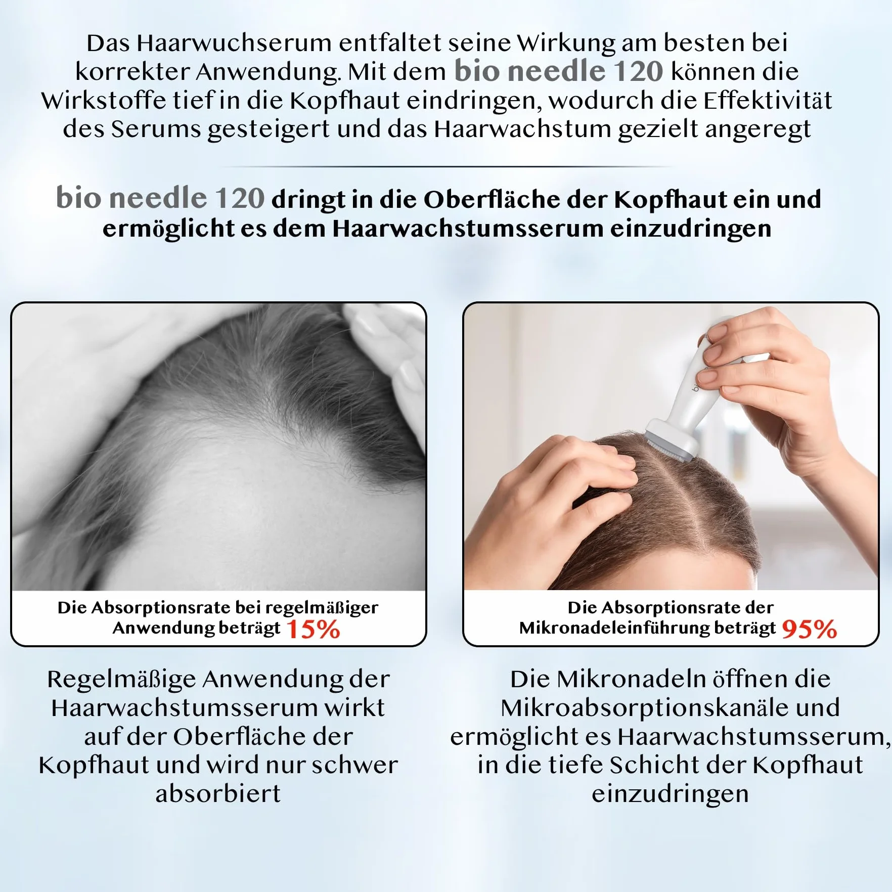 P-Beauty Derma Stamp – Dermapen – Microneedling – Mezoroller z 120 wysokiej jakości igłami ze stali nierdzewnej, regulowana długość 0-2 mm, do zapobiegania starzeniu się, regeneracji skóry