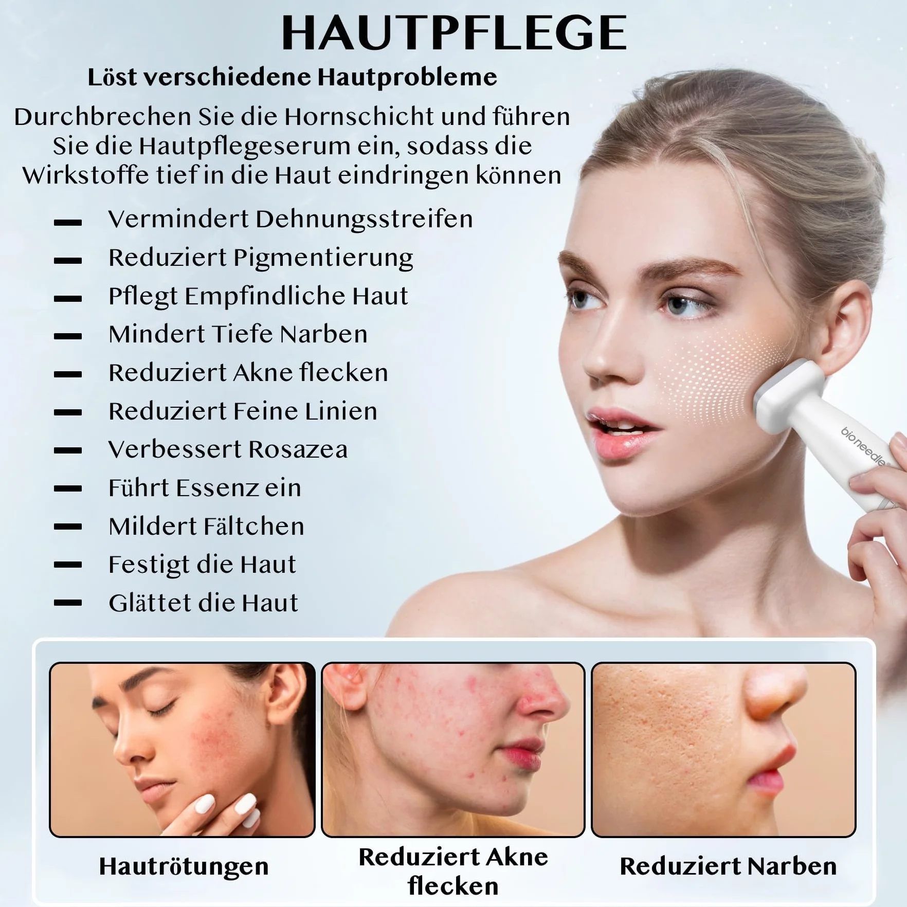 P-Beauty Derma Stamp – Dermapen – Microneedling – Mezoroller z 120 wysokiej jakości igłami ze stali nierdzewnej, regulowana długość 0-2 mm, do zapobiegania starzeniu się, regeneracji skóry