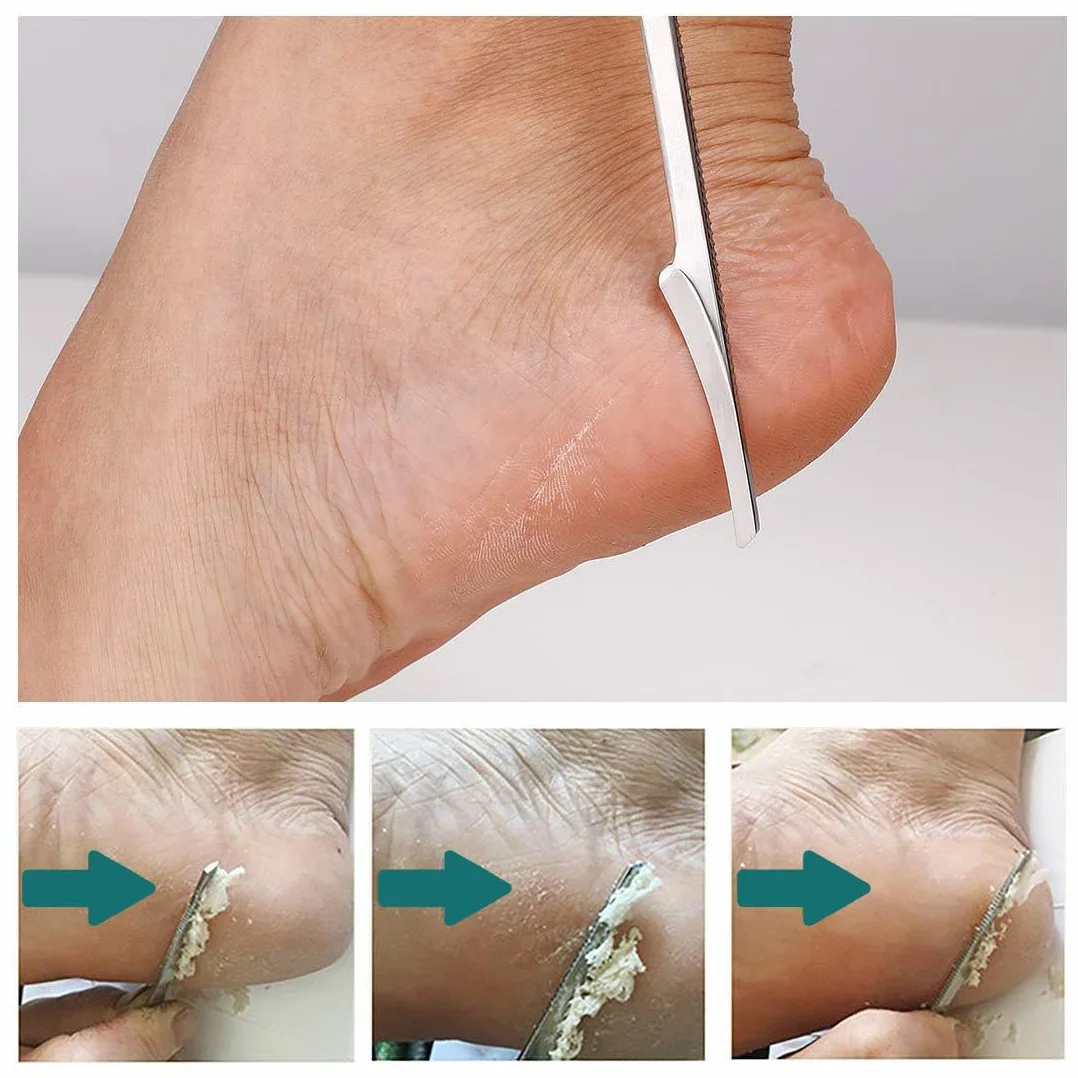 Profesjonalny nóż do pedicure, ostrza, ze stali nierdzewnej, do usuwania zrogowaciałego naskórka, skalpel, ostrze do pielęgnacji stóp, narzędzie do pedicure